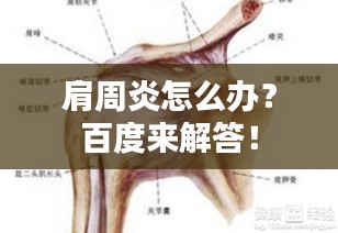 肩周炎怎么办？百度来解答！
