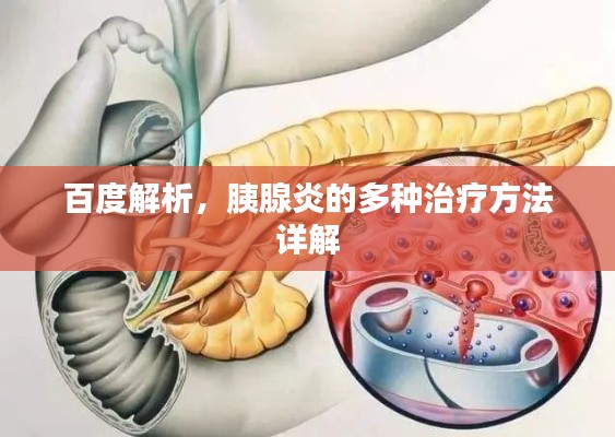 百度解析，胰腺炎的多种治疗方法详解