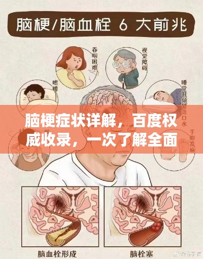 脑梗症状详解，百度权威收录，一次了解全面