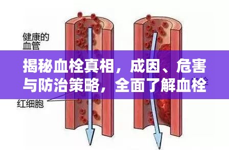 揭秘血栓真相，成因、危害与防治策略，全面了解血栓知识！