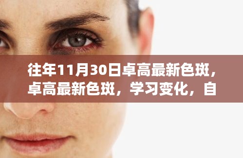 往年11月30日卓高最新色斑，卓高最新色斑，学习变化，自信闪耀，成就无限光彩的励志之旅