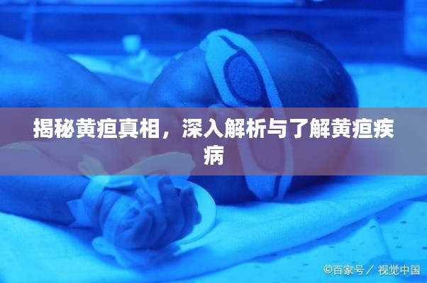 揭秘黄疸真相，深入解析与了解黄疸疾病