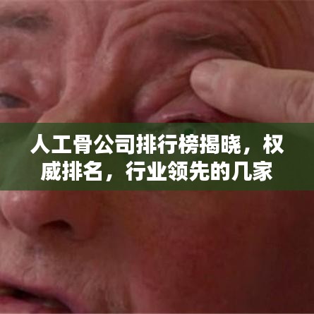 人工骨公司排行榜揭晓，权威排名，行业领先的几家公司是？
