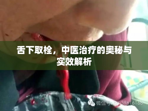 舌下取栓，中医治疗的奥秘与实效解析